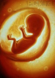 胎记是怎么形成的为什么有胎记